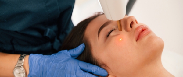 Láser ND YAG- Eliminación de manchas